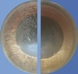 
Imagen de microscopio: Anteriormente (izquierda) la cal esponjosa puede asentarse. Más tarde (derecha) la cal pegada podría aflojar
